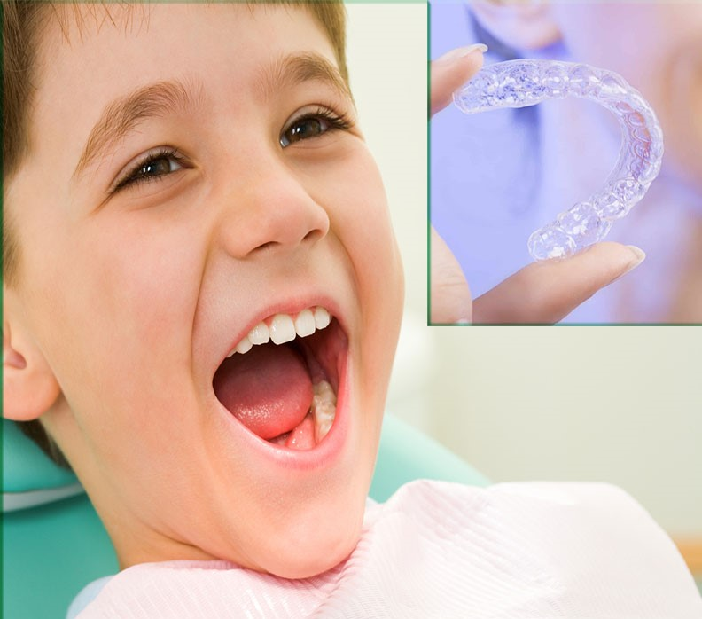 Niềng răng trong suốt cho trẻ em có mang lại hiệu quả không?
