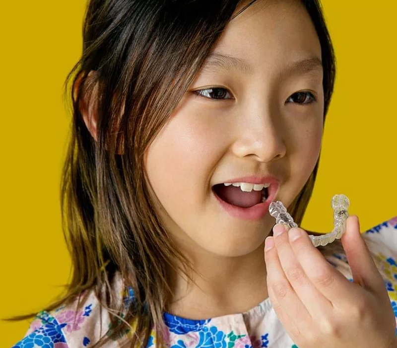 Áp dụng phương pháp niềng răng trong suốt cho trẻ thì cần lưu ý những gì?